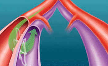 Imagen: el acoplador Rox, diseñado para resolver los problemas de la presión sanguínea, uniendo los vasos ilíacos (Fotografía cortesía de Rox Medical).